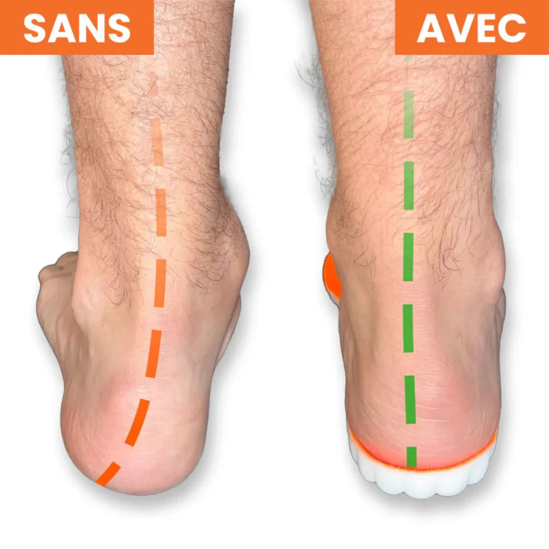 Soflex™ – Semelles de confort ergonomiques